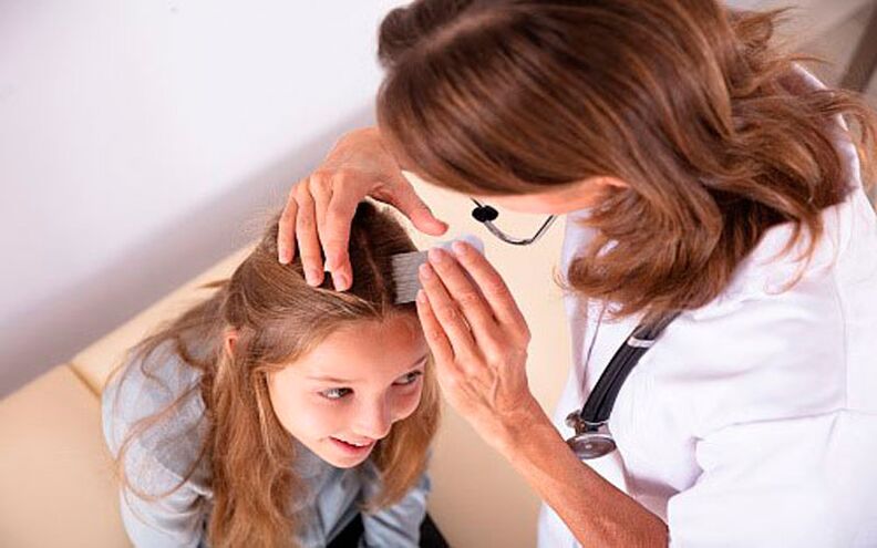 behandeling van hoofdpsoriasis bij kinderen