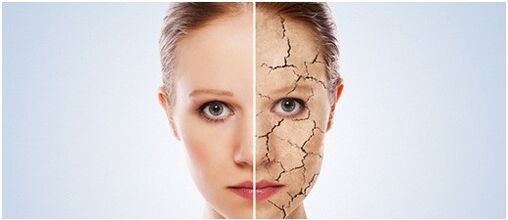 We behandelen psoriasis